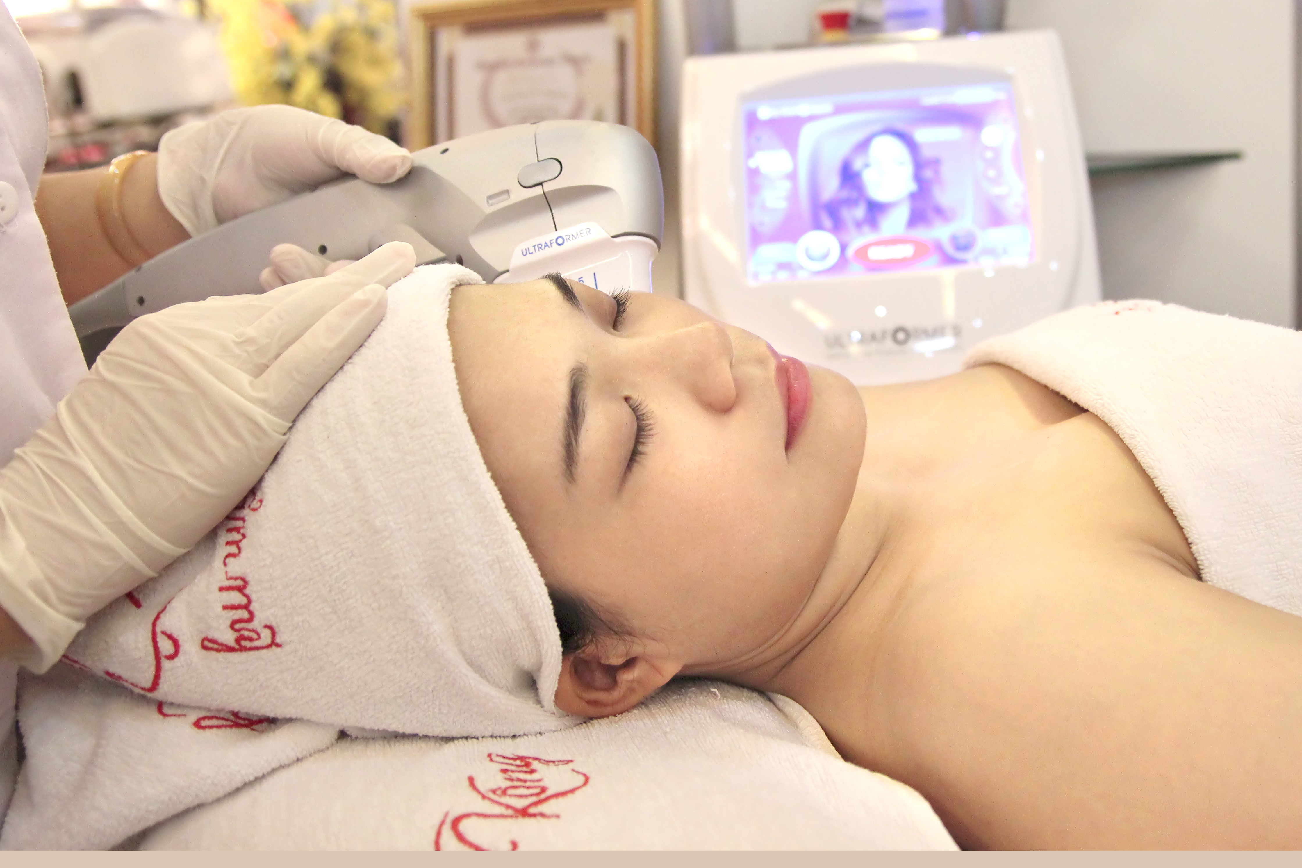 trẻ hóa da bằng hifu là gì tre hoa da bang hifu 3.jpg (4.66 MB)